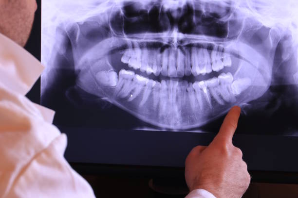 Emergency Gum Pain Relief in MN